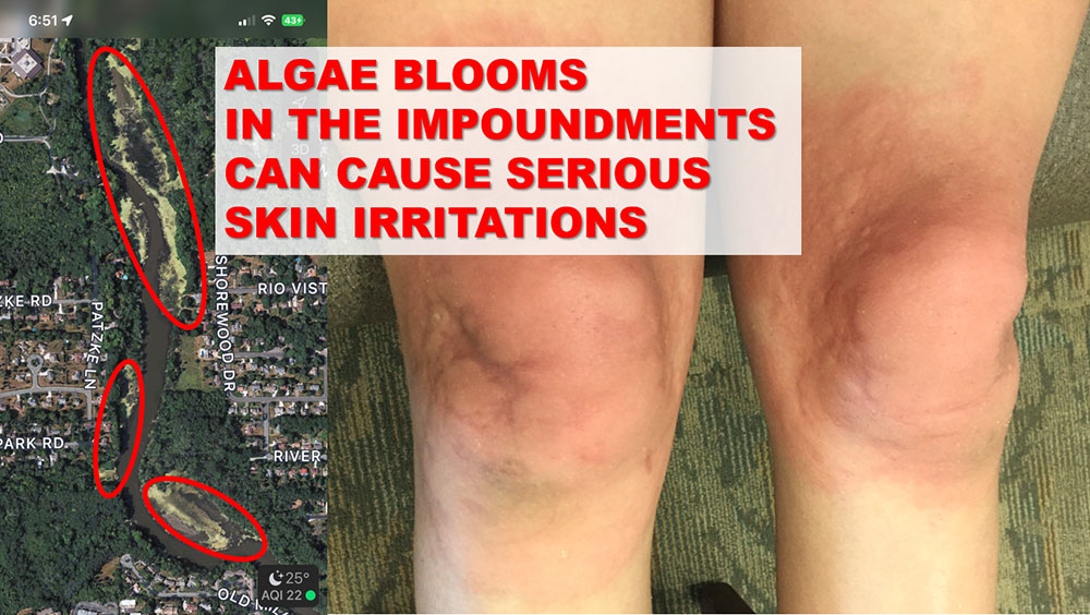 Toxic algae in impoundments can cause serious skin irritations.